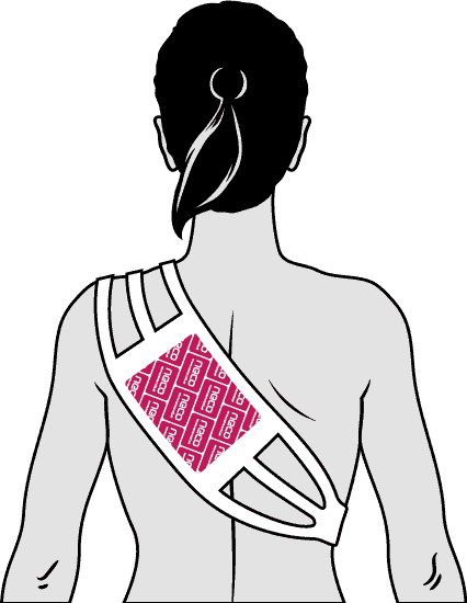 Der NECO STRAP white in Verbindung mit dem NECO warmingpad/ Wärmekissen auf dem Schulterblatt positioniert